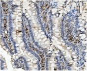 IHC staining of FFPE rat intestine with MMUT antibody. HIER: boil tissue sections in pH8 EDTA for 20 min and allow to cool before testing.