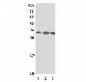 Beta NGF Antibody Cell Lysate WB. Western blot analysis of human U-87 MG, 22RV1, and A549 cell lysates using recombinant rabbit monoclonal clone BDE-14. Lane 1: U-87 MG lysate, Lane 2: 22RV1 lysate, Lane 3: A549 lysate. A prominent band is detected near 27-30 kDa, consistent with the reported molecular weight range of mature beta-NGF dimer-associated forms. The observed signal pattern aligns with processed Nerve growth factor expression and neurotrophin-associated signaling biology across multiple human cell types.