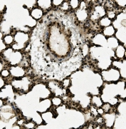 AHR Antibody Rat Lung IHC. Immunohistochemical staining of FFPE rat lung demonstrates AHR expression using an AHR antibody. AHR, also known as Aryl Hydrocarbon Receptor and an Environmental Sensor Protein, is a ligand activated transcription factor that regulates xenobiotic metabolism, immune responses, and cellular adaptation to environmental stimuli. Distinct cytoplasmic and nuclear staining is observed throughout the bronchial epithelium and alveolar cells, consistent with the role of AHR in pulmonary barrier function and responses to inhaled toxicants. Heat induced epitope retrieval was performed by boiling tissue sections in pH 8 EDTA buffer for 20 minutes followed by cooling prior to staining. These results support the utility of AHR Antibody for studies of toxicology, inflammation, and environmental sensing pathways.
