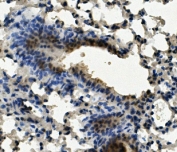 AHR Antibody Mouse Lung IHC. Immunohistochemical staining of FFPE mouse lung demonstrates AHR expression using an AHR antibody. AHR, also known as Aryl Hydrocarbon Receptor and an Environmental Sensor Protein, is a ligand activated transcription factor that integrates xenobiotic, dietary, and endogenous signals to regulate gene expression and immune homeostasis. Prominent nuclear and cytoplasmic staining is observed in bronchiolar epithelial cells and scattered alveolar cells, consistent with activation of AHR signaling pathways in the pulmonary microenvironment. Heat induced epitope retrieval was performed by boiling tissue sections in pH 8 EDTA buffer for 20 minutes followed by cooling prior to staining. These findings support the utility of AHR Antibody for studies of toxicology, barrier immunity, and environmental response pathways.