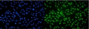 AHR Antibody A549 Cells IF. Immunofluorescent staining of FFPE human A549 cells demonstrates AHR expression using an AHR antibody (green). AHR, also known as Aryl Hydrocarbon Receptor and an Environmental Sensor Protein, is a ligand activated transcription factor that mediates cellular responses to xenobiotics, endogenous metabolites, and inflammatory signals. Prominent nuclear and perinuclear fluorescence is observed, consistent with the activation and nuclear translocation of AHR required for transcriptional regulation. DAPI nuclear stain identifies cell nuclei (blue). Heat induced epitope retrieval was performed by steaming sections in pH 6 citrate buffer for 20 minutes prior to staining. These results support the utility of AHR Antibody for studies of toxicology, signal transduction, immune regulation, and cancer biology.