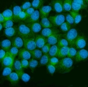 CAMK II alpha Antibody MCF7 Cell IF. Immunofluorescent staining of MCF7 cells with CAMK II alpha antibody (green). Heat-induced epitope retrieval (HIER) was performed by steaming sections in pH 6 citrate buffer for 20 minutes prior to staining. Nuclei are counterstained with DAPI (blue). CAMK II alpha immunoreactivity is observed predominantly within the cytoplasm, consistent with the expected localization of Calcium/Calmodulin Dependent Protein Kinase II Alpha (CAMK2A), a calcium signaling kinase that regulates calcium-dependent signal transduction, protein phosphorylation, and intracellular signaling pathways.