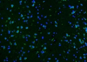CAMK II alpha Antibody Rat Brain IF. Immunofluorescent staining of FFPE rat brain tissue with CAMK II alpha antibody (green). Heat-induced epitope retrieval (HIER) was performed by steaming sections in pH 8 EDTA buffer for 20 minutes prior to staining. Nuclei are counterstained with DAPI (blue). CAMK II alpha immunoreactivity is observed in neuronal cell bodies and processes, consistent with the expected distribution of Calcium/Calmodulin Dependent Protein Kinase II Alpha (CAMK2A), a calcium signaling kinase that regulates synaptic plasticity, protein phosphorylation, learning, memory, and neuronal signal transduction.