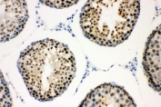 CCNE1 Antibody Rat Testis IHC. Immunohistochemistry staining of FFPE rat testis with CCNE1 antibody. HIER: boil tissue sections in pH8 EDTA for 20 min and allow to cool before testing.