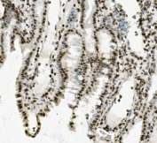 IHC staining of FFPE mouse intestine with PRDM5 antibody. HIER: boil tissue sections in pH8 EDTA for 20 min and allow to cool before testing.