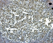 IHC staining of FFPE rat intestine with PRDM5 antibody. HIER: boil tissue sections in pH8 EDTA for 20 min and allow to cool before testing.