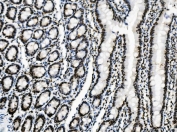 IHC staining of FFPE rat intestine with Vinexin antibody. HIER: boil tissue sections in pH8 EDTA for 20 min and allow to cool before testing.