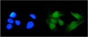 Immunofluorescence analysis of SS-A / TRIM21 antibody in FFPE human U-2 OS cells. SS-A antibody (green) shows prominent nuclear staining with additional diffuse cytoplasmic signal, while nuclei are counterstained with DAPI (blue); heat-induced epitope retrieval was performed by steaming sections in pH 6 citrate buffer for 20 min prior to staining.