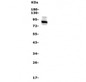 Western blot testing of rat brain lysate with Adam28 antibody. Predicted molecular weight ~87 kDa.