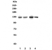 Western blot testing of human 1) HEK293, 2) K562, 3) PC-3 and 4) HeLa lysate with ATP11C antibody. Predicted molecular weight ~129 kDa.