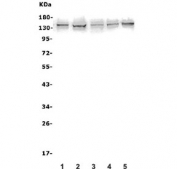 Western blot testing of human 1) A431, 2) U-2 OS, 3) U-87 MG, 4) PC-3 and 5) K562 lysate with AXL antibody. Expected molecular weight: 104-140 kDa depending on glycosylation level.