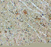 IHC staining of FFPE rat spinal cord with Chat antibody. HIER: boil tissue sections in pH8 EDTA for 20 min and allow to cool before testing.