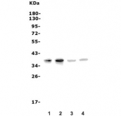 MC4-R Antibody Human Mouse Rat Cell Line WB. Western blot analysis of human U-87 MG and HEK293 cell lysates, together with rat PC-12 and mouse Neuro-2a cell lysates, using MC4-R antibody demonstrates a distinct immunoreactive band at approximately 37-40 kDa across all samples, consistent with expression of Melanocortin Receptor 4 (MC4-R). MC4-R is a G protein-coupled receptor that mediates melanocortin-dependent signaling pathways involved in energy homeostasis, appetite regulation, neuroendocrine communication, and metabolic control. The observed cross-species detection pattern supports the conserved nature of MC4-R and demonstrates the utility of this antibody for studies of melanocortin receptor biology and hormone-mediated signaling pathways. Predicted molecular weight: ~37 kDa.