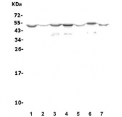 Western blot testing of rat 1) brain, 2) lung, 3) liver, 4) kidney, 5) testis, 6) smooth muscle and 7) C6 cell lysate with Olr1 antibody. Predicted molecular weight: pro-form 35-50 kDa, mature form ~31 kDa.