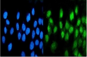 Immunofluorescent staining of FFPE human A431 cells with ATF1 antibody (green) and DAPI nuclear stain (blue). HIER: steam section in pH6 citrate buffer for 20 min.