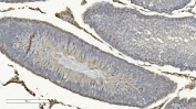 IHC staining of FFPE rat testis with Cox8a antibody. HIER: boil tissue sections in pH8 EDTA for 20 min and allow to cool before testing.
