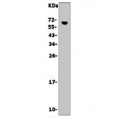 Cd16 Antibody Mouse Thymus WB. Western blot testing of mouse thymus lysate with Cd16 antibody. Expected molecular weight: 30-70 kDa depending on the level of glycosylation.