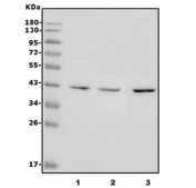 DUSP1 Antibody Human Cell Line Panel WB. Western blot analysis of DUSP1 expression was performed using anti-DUSP1 antibody in human U-87 MG, HeLa, and A549 cell lysates. DUSP1, also known as Dual Specificity Phosphatase 1 or MKP1 (MAP Kinase Phosphatase 1), is a stress-inducible phosphatase that negatively regulates MAPK signaling by dephosphorylating ERK, JNK, and p38 kinases. Lane 1: U-87 MG lysate. Lane 2: HeLa lysate. Lane 3: A549 lysate. A specific immunoreactive band is detected at approximately 39 kDa in all three cell lines, corresponding to the predicted molecular weight of DUSP1. The widespread expression observed across glioblastoma, cervical carcinoma, and lung carcinoma cells is consistent with the fundamental role of DUSP1 in regulating cellular stress responses and MAPK-mediated signal transduction. These results support the utility of DUSP1 Antibody for studies of MAPK regulation, inflammation, cellular adaptation, and cancer biology.