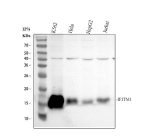 CD225 Antibody Human Cancer and Immune Cell WB. IFITM1 Antibody was used for Western blot analysis on lane 1: human K562, lane 2: human HeLa, lane 3: human HepG2, and lane 4: human Jurkat whole cell lysates. A distinct immunoreactive band is detected at approximately 14â17 kDa in each sample, consistent with the expected molecular weight of IFITM1. Variable expression is observed across the different cell lines, with the strongest signal detected in K562 cells. This IFITM1 Antibody / CD225 Antibody is well suited for Western blot studies of CD225 expression, interferon signaling, innate immunity, antiviral defense, and immune cell biology.
