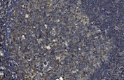 IHC staining of FFPE human tonsil tissue with OTULIN antibody. HIER: boil tissue sections in pH8 EDTA for 20 min and allow to cool before testing.