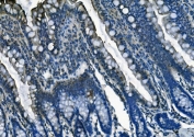 PI16 Antibody in rat intestine by immunohistochemistry. Formalin-fixed paraffin-embedded rat intestine tissue stained with PI16 / Peptidase inhibitor 16 antibody shows HRP-DAB chromogenic staining within epithelial cells lining the intestinal villi. Positive signal is observed predominantly in the cytoplasm of enterocytes along the villus epithelium, outlining the villus architecture, while most lamina propria cells display minimal staining. Heat induced epitope retrieval was performed by boiling tissue sections in pH 8 EDTA buffer for 20 minutes followed by cooling prior to antibody incubation.