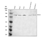 RAG1 Antibody Human and Mouse Cell and Thymus WB. Western blot analysis was performed under reducing conditions using 30 ug of lysate per lane. Lane 1: human Jurkat cells; Lane 2: human K562 cells; Lane 3: human A431 cells; Lane 4: mouse thymus tissue; Lane 5: mouse RAW264.7 cells. The membrane was incubated overnight at 4Â°C with rabbit anti-RAG1 antibody at 0.5 ug/ml, followed by an HRP-conjugated secondary antibody and ECL detection. A specific band was observed at approximately 119 kDa, matching the expected size of RAG1. RAG1 Antibody, recognizing recombination activating gene 1, supports studies of VDJ recombination and lymphocyte development.