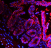 Epcam Antibody Mouse Intestine IF. Immunofluorescent staining of FFPE mouse intestine tissue using Epcam Antibody demonstrates strong red fluorescence localized predominantly to the epithelial lining of intestinal villi and crypt structures. The staining pattern is consistent with expression of Epithelial Cell Adhesion Molecule (EPCAM/CD326), a transmembrane glycoprotein involved in epithelial cell adhesion, maintenance of tissue architecture, and regulation of epithelial differentiation. Prominent membrane-associated fluorescence outlines the intestinal epithelial compartment and highlights the organized cellular structure of the mucosal lining. Nuclei are counterstained with DAPI (blue). The observed staining supports the use of Epcam as a marker for epithelial cell identification, intestinal epithelial biology, and studies of tissue organization and epithelial homeostasis in mouse tissues. HIER: steam tissue sections in pH 8 EDTA buffer for 20 minutes prior to staining.