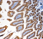 Epcam Antibody Mouse Intestine IHC. Immunohistochemistry staining of FFPE mouse intestine tissue using Epcam Antibody demonstrates strong membranous HRP-DAB brown staining throughout the epithelial lining of intestinal villi and crypt structures. The staining pattern is consistent with expression of Epithelial Cell Adhesion Molecule (EPCAM/CD326), a transmembrane glycoprotein involved in epithelial cell adhesion, maintenance of tissue architecture, and regulation of epithelial differentiation. Prominent membrane-associated staining outlines individual enterocytes and highlights the highly organized epithelial compartment of the intestinal mucosa. The observed immunoreactivity is consistent with the established expression of EPCAM in gastrointestinal epithelial tissues and supports the use of Epcam as a marker for epithelial cell identification, intestinal biology studies, and investigations of epithelial tissue homeostasis in mouse models. HIER: boil tissue sections in pH 8 EDTA buffer for 20 minutes and allow to cool before testing.