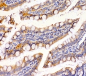 Epcam Antibody Rat Intestine IHC. Immunohistochemistry staining of FFPE rat intestine tissue using Epcam Antibody demonstrates distinct membranous HRP-DAB brown staining throughout the intestinal epithelial lining, including absorptive enterocytes and crypt-associated epithelial cells. The staining pattern is consistent with expression of Epithelial Cell Adhesion Molecule (EPCAM/CD326), a cell surface glycoprotein that mediates epithelial cell adhesion and contributes to maintenance of epithelial architecture and tissue integrity. Prominent membrane localization highlights epithelial cell boundaries along the mucosal surface and is characteristic of EPCAM expression in gastrointestinal epithelial tissues. The observed immunoreactivity supports the use of Epcam as a marker for epithelial cell identification, intestinal epithelial differentiation, and studies of epithelial biology in rat models. HIER: boil tissue sections in pH 8 EDTA buffer for 20 minutes and allow to cool before testing.