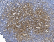 GCHFR Antibody Tonsil IHC. Immunohistochemistry analysis of FFPE human tonsil tissue stained with GCHFR Antibody demonstrates diffuse cytoplasmic HRP-DAB brown staining throughout lymphoid-associated cellular populations, consistent with the role of GTP cyclohydrolase I feedback regulator / GCHFR in tetrahydrobiopterin metabolism and nitric oxide-associated cellular signaling pathways. The observed staining profile aligns with the involvement of BH4 regulatory pathways in immune-associated metabolic activity and cytokine-responsive signaling environments. HIER: boil tissue sections in pH 8 EDTA for 20 min and allow to cool before testing.
