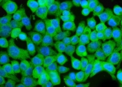 GCHFR Antibody Caco-2 IF. Immunofluorescence analysis of FFPE human Caco-2 cells stained with GCHFR Antibody demonstrates diffuse cytoplasmic green fluorescence consistent with the localization of GTP cyclohydrolase I feedback regulator / GCHFR, a BH4-associated metabolic regulatory protein involved in nitric oxide signaling and cofactor homeostasis pathways. DAPI nuclear counterstain is shown in blue. HIER: steam sections in pH 6 citrate buffer for 20 min prior to staining.