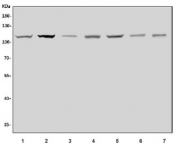 NALP3 Antibody Multi-Species WB. Western blot analysis of 1) human HeLa, 2) human U-87 MG, 3) rat spleen, 4) rat PC-12, 5) mouse thymus, 6) mouse lung, and 7) mouse spleen lysates using NALP3 Antibody. Bands are detected near approximately 110-120 kDa across multiple human, rat, and mouse samples, consistent with the predicted molecular weight of NLRP3 / NALP3 / Cryopyrin, an innate immune signaling protein involved in inflammasome activation, inflammatory regulation, cytokine maturation, and pyroptosis-associated cellular pathways.