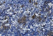 TIGIT Antibody Mouse Spleen IHC. Immunohistochemistry analysis of FFPE mouse spleen tissue using TIGIT Antibody demonstrates HRP-DAB brown membranous and cytoplasmic staining in subsets of lymphoid cells within the splenic parenchyma, consistent with TIGIT expression on activated T cells and NK cells, and reflecting broad epitope detection across immune cell populations, while surrounding cells show lower signal; nuclei are counterstained blue. HIER: boil tissue sections in pH 8 EDTA for 20 min and allow to cool before testing.