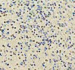 YTHDC1 Antibody Rat Brain IHC. Immunohistochemical analysis of YTHDC1 Antibody / Nuclear m6A Reader Protein Antibody in FFPE rat brain tissue. Following heat-induced epitope retrieval in pH 8.0 EDTA buffer, sections were stained with YTHDC1 antibody at 2 ug/ml and detected using an HRP-conjugated secondary antibody with DAB chromogen. Strong nuclear staining is observed throughout the brain tissue, consistent with the predominantly nuclear localization of YTHDC1 as an m6A RNA reader involved in RNA processing and gene regulation. This YTHDC1 Antibody, a Nuclear m6A Reader Protein Antibody, is suitable for investigating nuclear RNA metabolism and epitranscriptomic regulation in tissue sections.