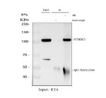 YTHDC1 Antibody RT4 Cell IP. Immunoprecipitation of YTHDC1 Antibody / Nuclear m6A Reader Protein Antibody from RT4 whole cell lysate followed by Western blot analysis. Lane 1: RT4 input lysate (30 ug); Lane 2: rabbit control IgG immunoprecipitation; Lane 3: YTHDC1 antibody immunoprecipitation using 2 ug antibody with 500 ug RT4 lysate. Immunoblot detection was performed using the same YTHDC1 antibody at 0.5 ug/ml. A specific band is detected at approximately 110 kDa, despite a predicted molecular weight of approximately 85 kDa, confirming efficient enrichment of endogenous YTHDC1. This YTHDC1 Antibody, a Nuclear m6A Reader Protein Antibody, is suitable for immunoprecipitation studies of m6A RNA-binding complexes and nuclear RNA processing.