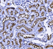 IHC staining of FFPE rat kidney with ANPEP antibody. HIER: boil tissue sections in pH8 EDTA for 20 min and allow to cool before testing.