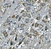 Cd97 Antibody Mouse Brain Immunohistochemistry. IHC staining of FFPE mouse brain with Cd97 antibody. HIER: boil tissue sections in pH8 EDTA for 20 min and allow to cool before testing.