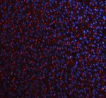 Cadherin 2 Antibody Rat Heart Tissue IF. Immunofluorescent staining of FFPE rat heart tissue with Cadherin 2 Antibody at 5 ug/ml demonstrates CDH2 expression (red). Heat-induced epitope retrieval was performed in pH8 EDTA buffer, followed by blocking with 10% goat serum. Sections were incubated with primary antibody overnight at 4Â°C, followed by Cy3-conjugated secondary antibody, with DAPI nuclear counterstain (blue). Red fluorescence demonstrates Cadherin 2 localization within the cardiac tissue. This Cadherin 2 Antibody, also called CDH2 Antibody, supports studies of N-Cadherin expression, cell-cell adhesion, and cardiac tissue biology.
