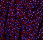 Cadherin 2 Antibody Rat Cardiac Tissue IF. Immunofluorescent staining of FFPE rat heart tissue with Cadherin 2 Antibody at 5 ug/ml demonstrates CDH2 expression (red). Heat-induced epitope retrieval was performed in pH8 EDTA buffer, followed by blocking with 10% goat serum. Sections were incubated with primary antibody overnight at 4Â°C, followed by Cy3-conjugated secondary antibody, with DAPI nuclear counterstain (blue). Red fluorescence demonstrates Cadherin 2 localization within the cardiac tissue. This Cadherin 2 Antibody, also called CDH2 Antibody, supports studies of N-Cadherin expression, cell-cell adhesion, and cardiac biology.