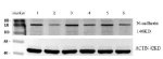 Cadherin 2 Antibody Human Cervical Cancer WB. Western blot analysis of paired human cervical cancer and adjacent tissue lysates with Cadherin 2 Antibody at 1:1000. Lanes 1, 3, and 5 contain cervical cancer tissue lysates; lanes 2, 4, and 6 contain corresponding adjacent tissue lysates. A prominent band is detected at approximately 140 kDa, consistent with the expected molecular weight of approximately 150 kDa for N-Cadherin/CDH2. Actin at approximately 42 kDa is shown as a loading control. This Cadherin 2 Antibody, also called CDH2 Antibody, supports studies of N-Cadherin expression, epithelial-mesenchymal transition, and cervical cancer biology.