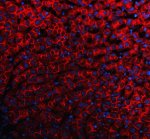 Cadherin 2 Antibody Human Liver Tissue IF. Immunofluorescent staining of FFPE human liver tissue with Cadherin 2 Antibody at 5 ug/ml demonstrates CDH2 expression (red). Heat-induced epitope retrieval was performed in pH8 EDTA buffer, followed by blocking with 10% goat serum. Sections were incubated with primary antibody overnight at 4Â°C, followed by Cy3-conjugated secondary antibody, with DAPI nuclear counterstain (blue). Prominent red fluorescence is observed along cell borders and membranes. This Cadherin 2 Antibody, also called CDH2 Antibody, supports studies of N-Cadherin localization, cell-cell adhesion, and tissue organization.