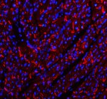 Cadherin 2 Antibody Mouse Heart Tissue IF. Immunofluorescent staining of FFPE mouse heart tissue with Cadherin 2 Antibody at 5 ug/ml demonstrates CDH2 expression (red). Heat-induced epitope retrieval was performed in pH8 EDTA buffer, followed by blocking with 10% goat serum. Sections were incubated with primary antibody overnight at 4Â°C, followed by Cy3-conjugated secondary antibody, with DAPI nuclear counterstain (blue). Red fluorescence demonstrates Cadherin 2 localization within the cardiac tissue. This Cadherin 2 Antibody, also called CDH2 Antibody, supports studies of N-Cadherin expression, cell-cell adhesion, and cardiac tissue organization.