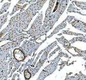 IHC staining of FFPE rat heart with Cadherin 13 antibody. HIER: boil tissue sections in pH8 EDTA for 20 min and allow to cool before testing.