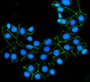 Claudin 7 Antibody MCF7 Cells IF. Immunofluorescence analysis of human MCF7 cells stained with Claudin 7 Antibody (green) demonstrates distinct membranous localization at cell-cell junctions consistent with tight junction organization, while nuclei are counterstained with DAPI (blue); heat-induced epitope retrieval was performed in pH 8 EDTA buffer.