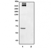 CSPG4 Antibody A375 WB. Western blot analysis of human A375 melanoma and MCF7 breast carcinoma cell lysates using CSPG4 antibody demonstrates a strong broad high molecular weight band in A375 cells migrating above 250 kDa, consistent with heavily glycosylated CSPG4 / NG2 proteoglycan. An additional lower molecular weight band near 60-70 kDa may represent a processed or partially glycosylated CSPG4-associated species. Minimal signal is observed in MCF7 cells, supporting the melanoma-associated expression profile of MCSP / CSPG4.