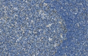 IHC staining of FFPE human tonsil with Interleukin 37 antibody. HIER: boil tissue sections in pH8 EDTA for 20 min and allow to cool before testing.