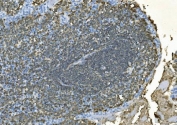 IHC staining of FFPE human tonsil with CD20 antibody. HIER: boil tissue sections in pH8 EDTA for 20 min and allow to cool before testing.