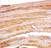 PSEN2 Antibody Skeletal Muscle IHC. Immunohistochemistry staining of FFPE human skeletal muscle with PSEN2 antibody. HIER: boil tissue sections in pH8 EDTA for 20 min and allow to cool before testing.