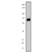 Oat3 Antibody / Slc22a8 Mouse Kidney WB. Western blot analysis of mouse kidney lysate using Oat3 Antibody / Slc22a8 Antibody demonstrates a distinct band at approximately 60 kDa, consistent with the predicted molecular weight of Organic Anion Transporter 3 (OAT3/Slc22a8). OAT3 is a membrane-associated transporter involved in the uptake and transport of organic anions, endogenous metabolites, pharmaceutical compounds, and xenobiotic substances. The observed band supports expression of OAT3 in renal tissue and validates the antibody for Western blot applications investigating kidney physiology, transporter biology, and drug transport mechanisms.