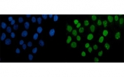 PARP1 Antibody A431 IF. Immunofluorescence analysis of human A431 cells using PARP1 antibody. PARP1 staining (green) demonstrates strong nuclear localization consistent with the chromatin-associated role of this repair protein in DNA strand break signaling, genomic stability maintenance, and nuclear stress-response pathways. Nuclei are counterstained blue with DAPI. Heat-induced epitope retrieval was performed by steaming sections in pH6 citrate buffer for 20 minutes prior to staining.